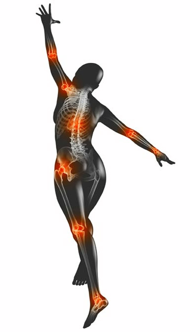 rheumaflex_women